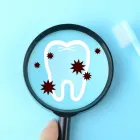 汚れ