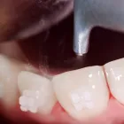 クリーニング